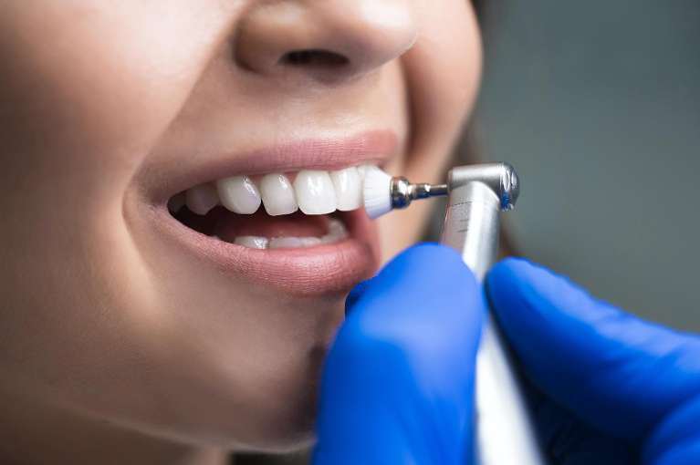 close up of woman getting a dental procedure in brockport ny