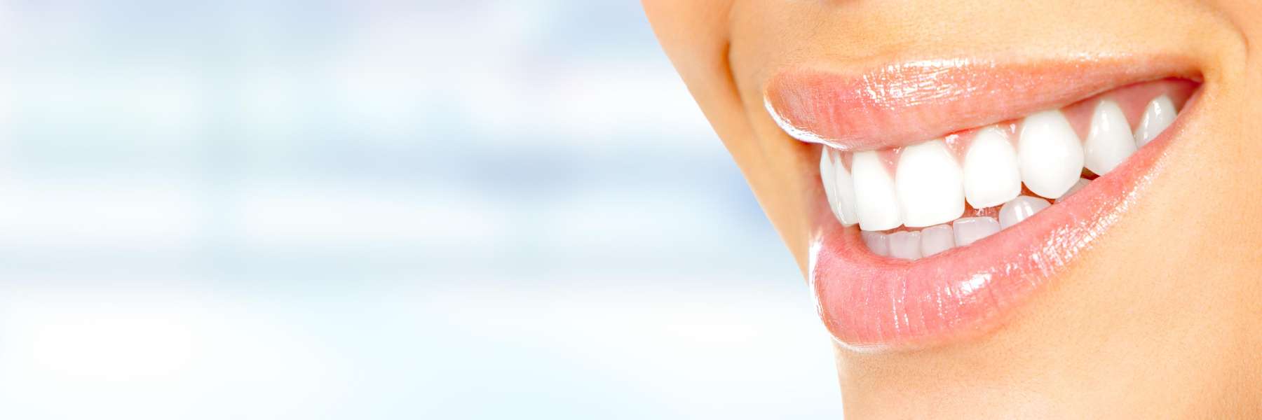 woman smiling after getting porcelain veneers