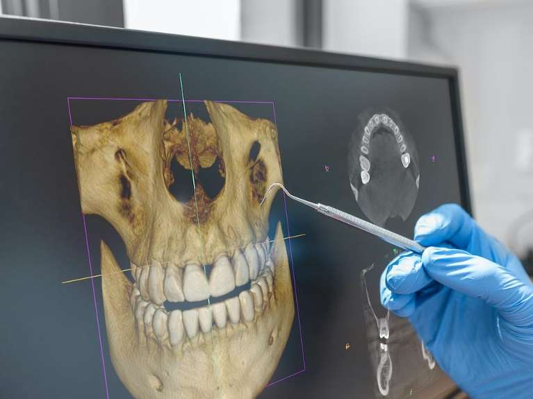 3-D Cone Beam Computed Tomography (CBCT)