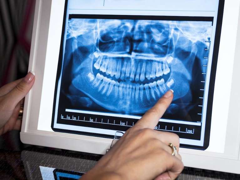 Panoramic X-Ray machine